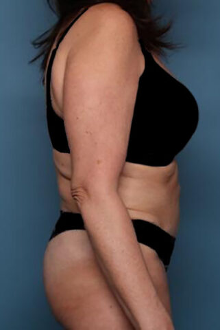 Case # 5 before photo