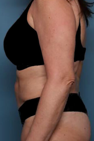 Case # 5 before photo