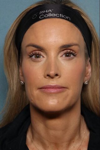 Case # 30 after photo