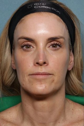 Case # 30 before photo