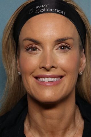 Case # 30 after photo