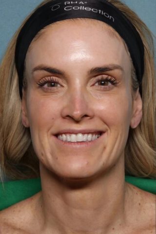 Case # 30 before photo