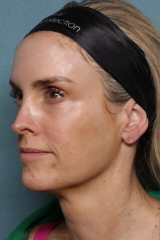 Case # 30 before photo