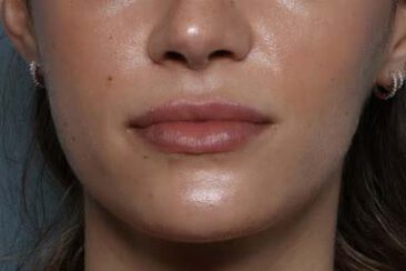 Case # 25 after photo