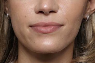 Case # 25 before photo