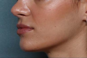 Case # 25 after photo