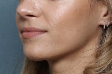 Case # 25 before photo