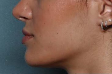 Case # 25 after photo