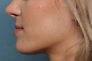 Case # 25 before photo