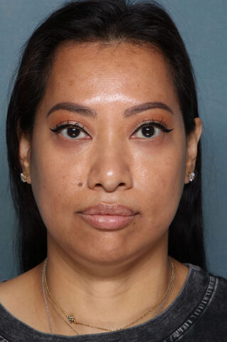 Case # 29 before photo