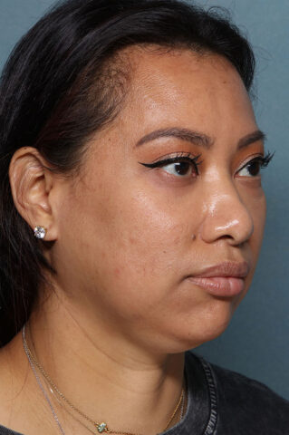 Case # 29 before photo