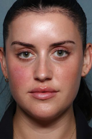 Case # 28 after photo