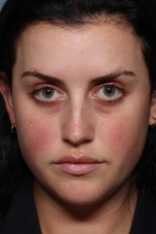 Case # 28 before photo