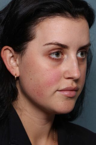 Case # 28 before photo