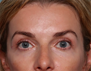 Case # 2 after photo