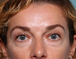 Case # 2 before photo