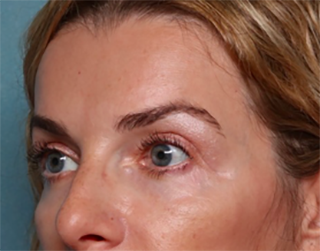 Case # 2 after photo