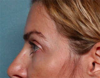 Case # 2 after photo