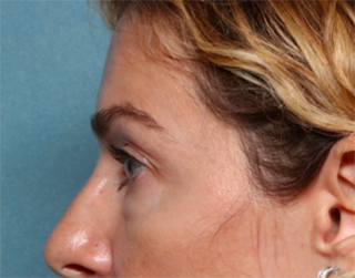 Case # 2 before photo