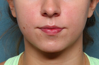 Case # 24 before photo