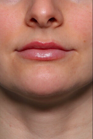 Case # 27 after photo