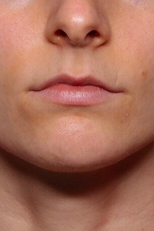 Case # 27 before photo