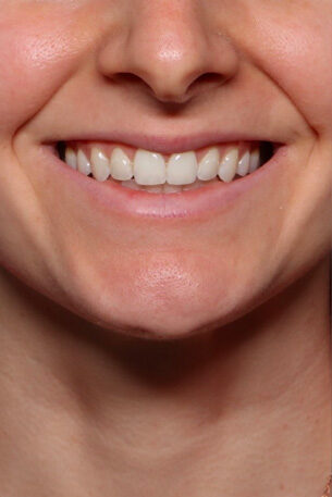 Case # 27 before photo