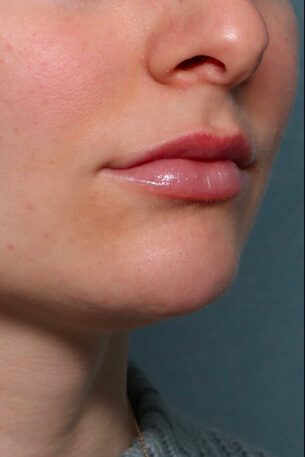 Case # 27 after photo