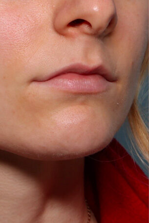 Case # 27 before photo