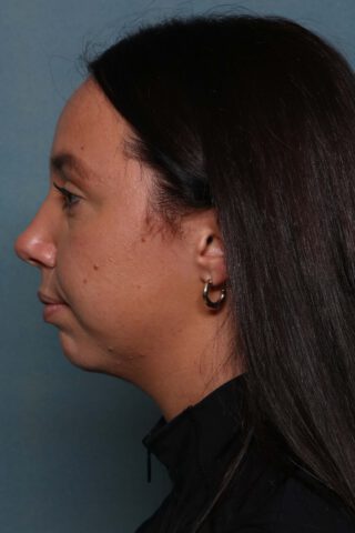 Case # 26 before photo