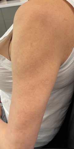 Case # 36 after photo