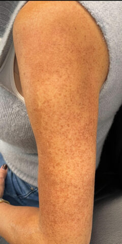 Case # 36 before photo