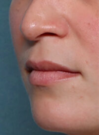 Case # 1 before photo