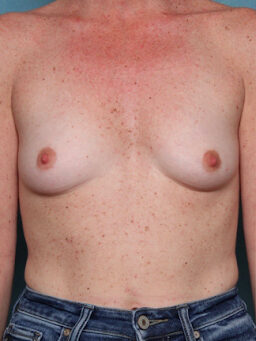 Case # 40 before photo