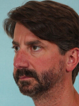 Case # 25 before photo