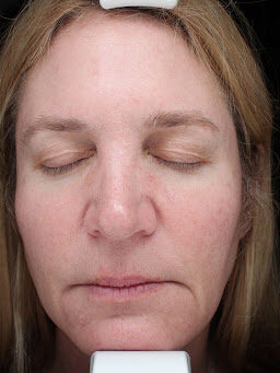 Case # 34 after photo