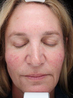 Case # 34 before photo