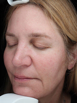 Case # 34 after photo