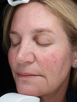 Case # 34 before photo