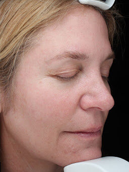 Case # 34 after photo