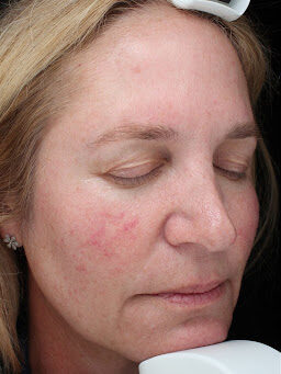 Case # 34 before photo