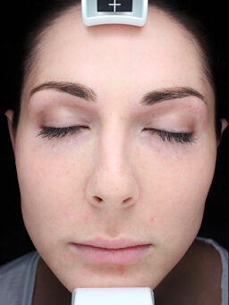 Case # 33 after photo