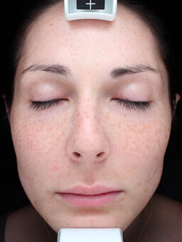 Case # 33 before photo