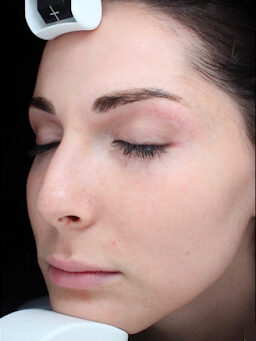 Case # 33 after photo