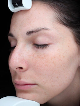 Case # 33 before photo