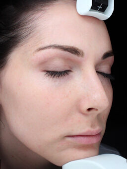 Case # 33 after photo