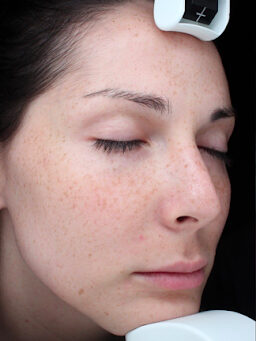 Case # 33 before photo