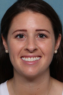 Case # 23 before photo