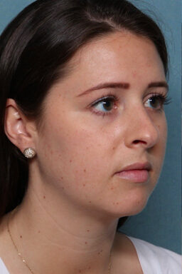 Case # 23 before photo