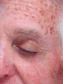 Case # 32 before photo